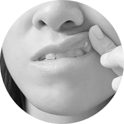 mouth ulcers mouth ulcers